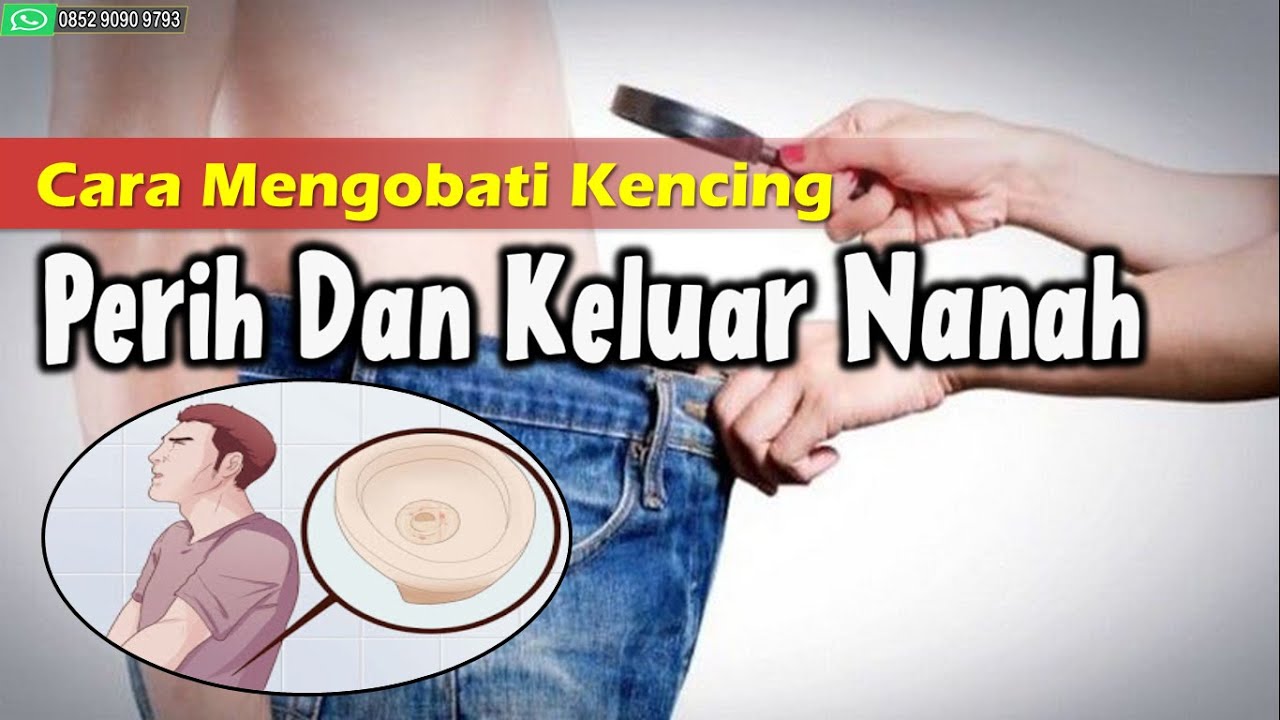 Cara Mengobati Kencing Perih Dan Keluar Nanah