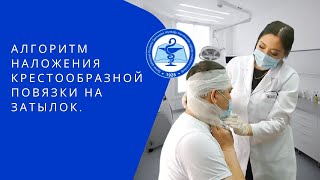 Алгоритм наложения крестообразной повязки на затылок.