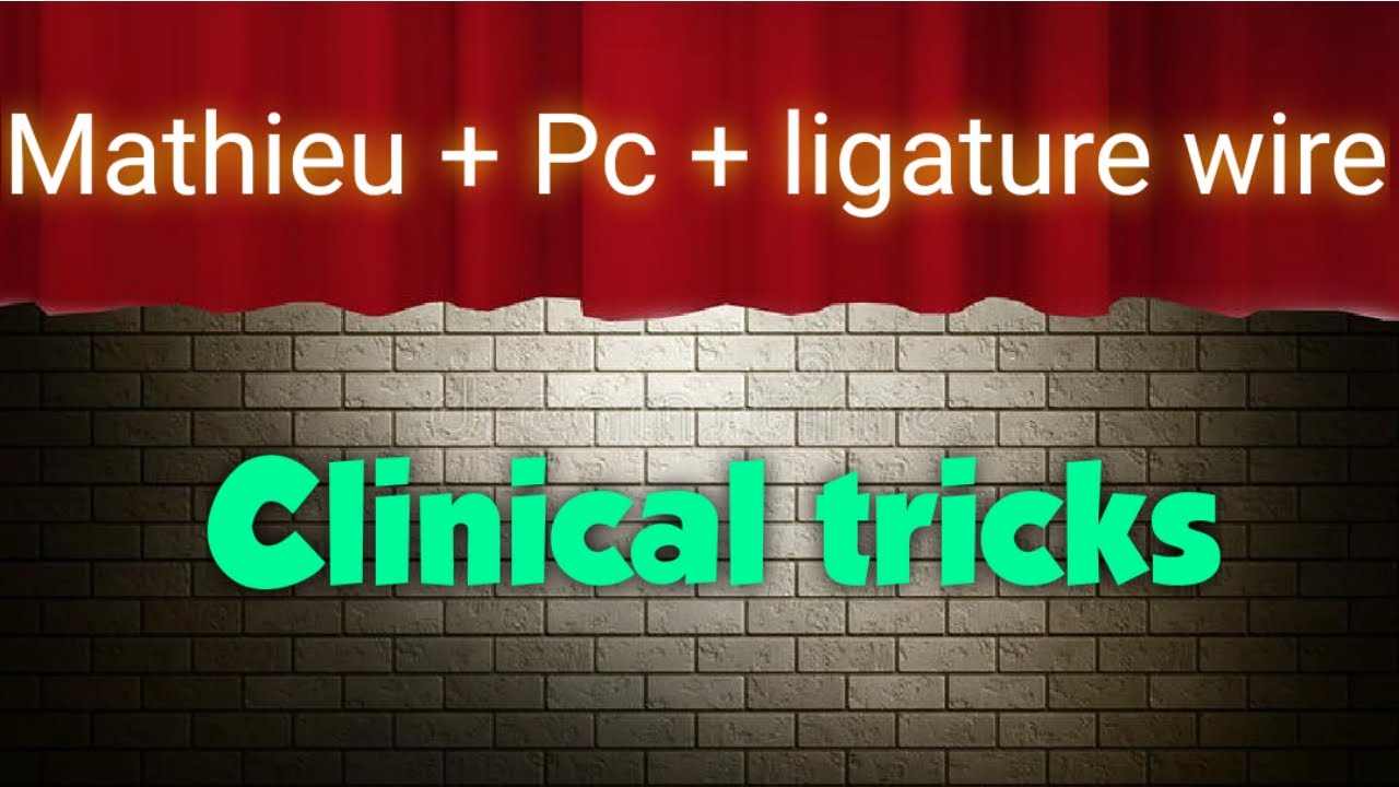 Orthodontic trick ligature wire + Powerchain + Mathieu YouTube