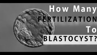 How Many Fertilized Eggs Make It to Day 5 - The Blastocyst Stage