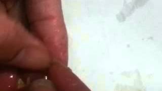 How To Clean Finger Nails & Cuticle By Lemonade.