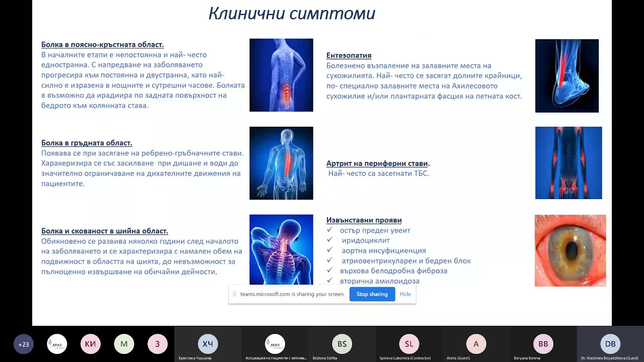 Световен ден на Анкилозиращ Спондилит (болест на Бехтерев)