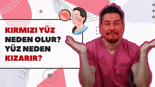 🔴 Kırmızı Yüz Neden Olur❓ Yüz Neden Kızarır❓ Resimi