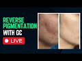 Reverse pigmentation with natural diet