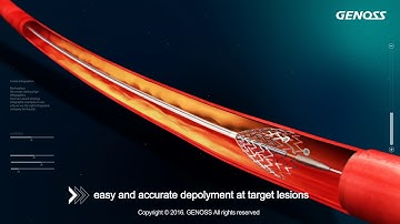 Genoss Peripheral Stent System