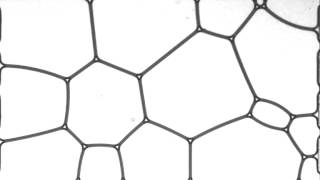 2D foam microfluidics