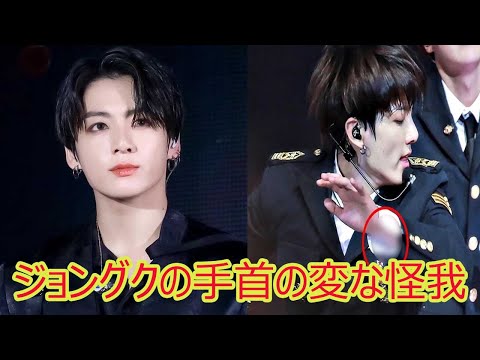 「BTSジョングクの手首の変な怪我。。。自己虐待か、それともひっかくガールフレンド？