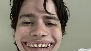 Looksmaxxing Completely Ruined His Teeth… 😔