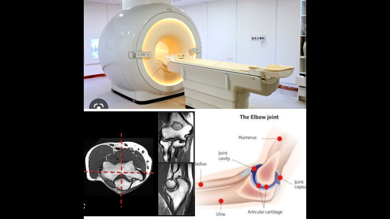 MRI ELBOW JOINT PLANNING AND POSITIONING ON PHILIPS 3T 