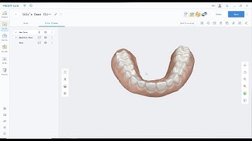 Medit link X UNIZ Dental Workflow