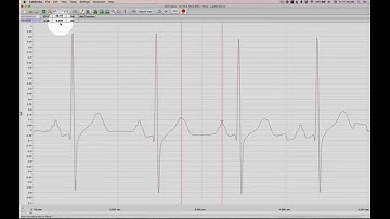 Tutorial 05a - Basic ECG Measurements in LabScribe