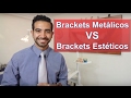 Brackets metálicos o  estéticos. ¿Cuál es mejor?/Ortodoncia en Querétaro