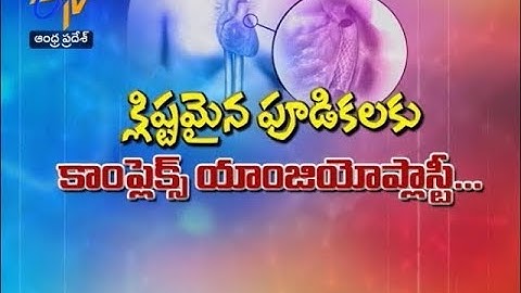 Complex Angioplasty: Treating Severe Heart Blockages Safely | Dr A Sharath Reddy