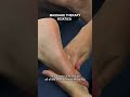 Can Foot Massage Help Sciatica 