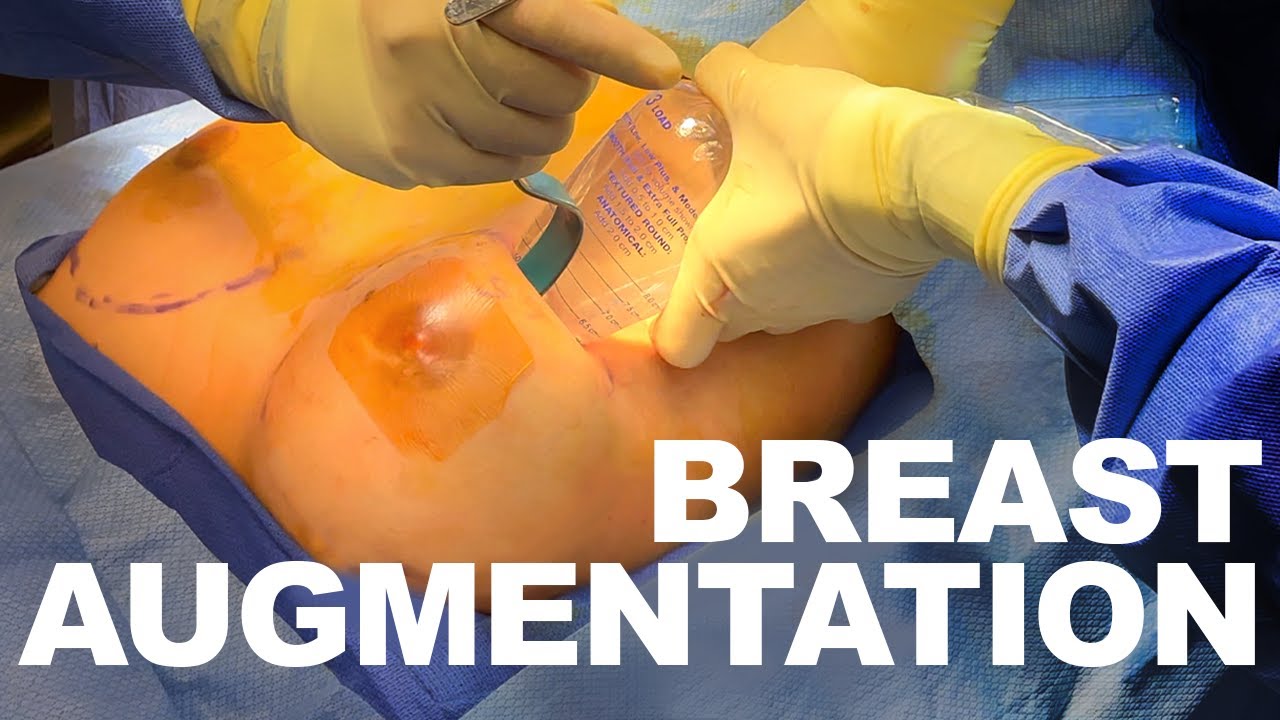 Breast Augmentation Surgeon