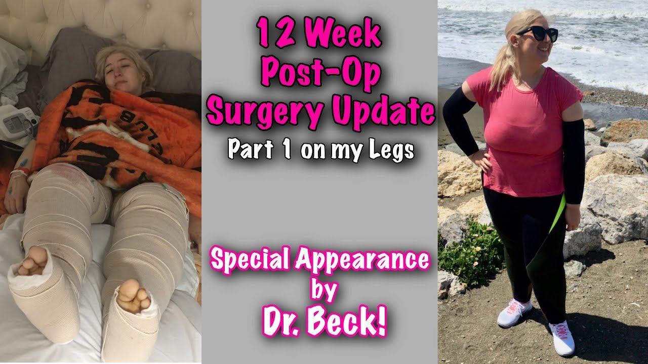 My Skin Removal Journey After Losing 350 Pounds Surgery 5 Updates