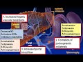 Lhypertension portale  partie 02 physiopathologie suite