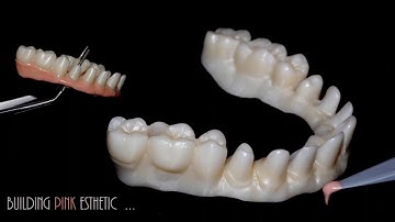 IPS emax at a glance!