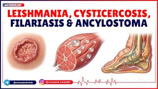 55. Leishmania, Cysticercosis, Filariasis & Ancylostoma: The Complete Microbiology Parasite Guide 🩺