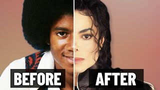 How Many Surgeries Did Michael Jackson Really Have?