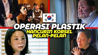 Operasi Plastik Perlahan Menghancurkan Korea Selatan — Ini Alasannya