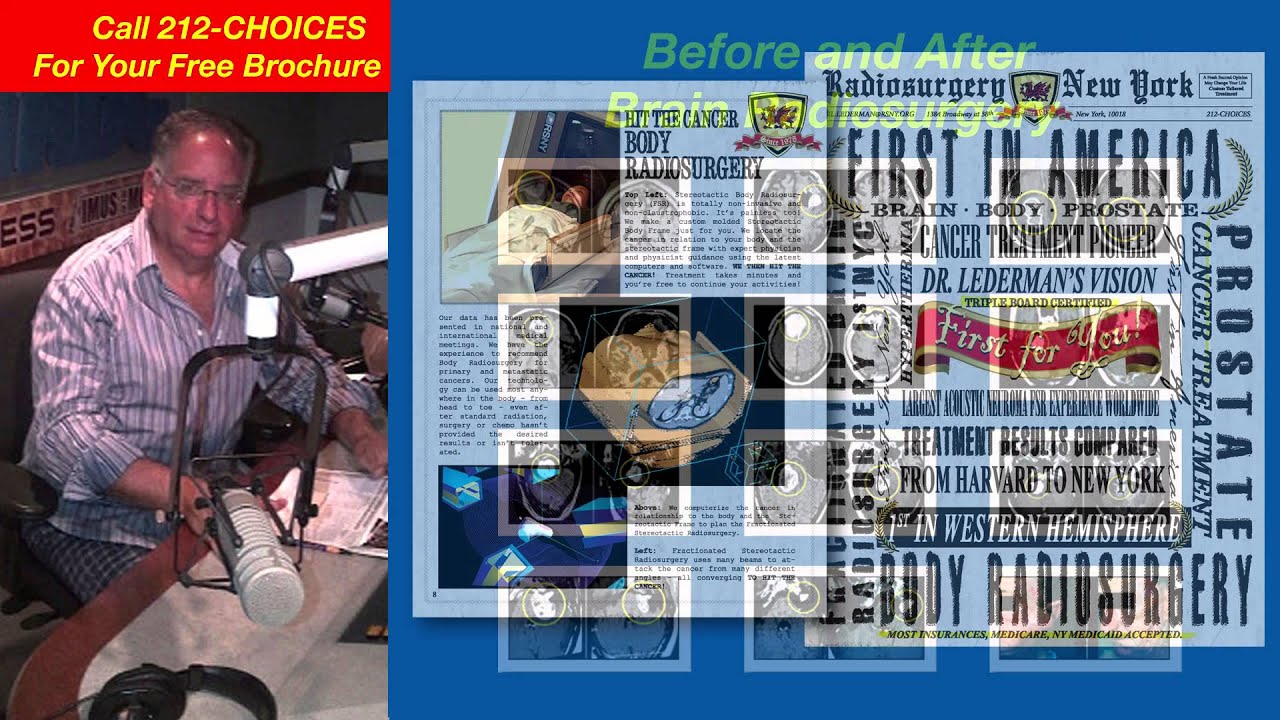 Dr. Gil Lederman's Radiosurgery Show! Podcast 91 Part THREE YouTube