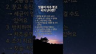 잇몸이 자주 붓고 피가 난다면? #shorts #잇몸건강관리 #잇몸병예방법