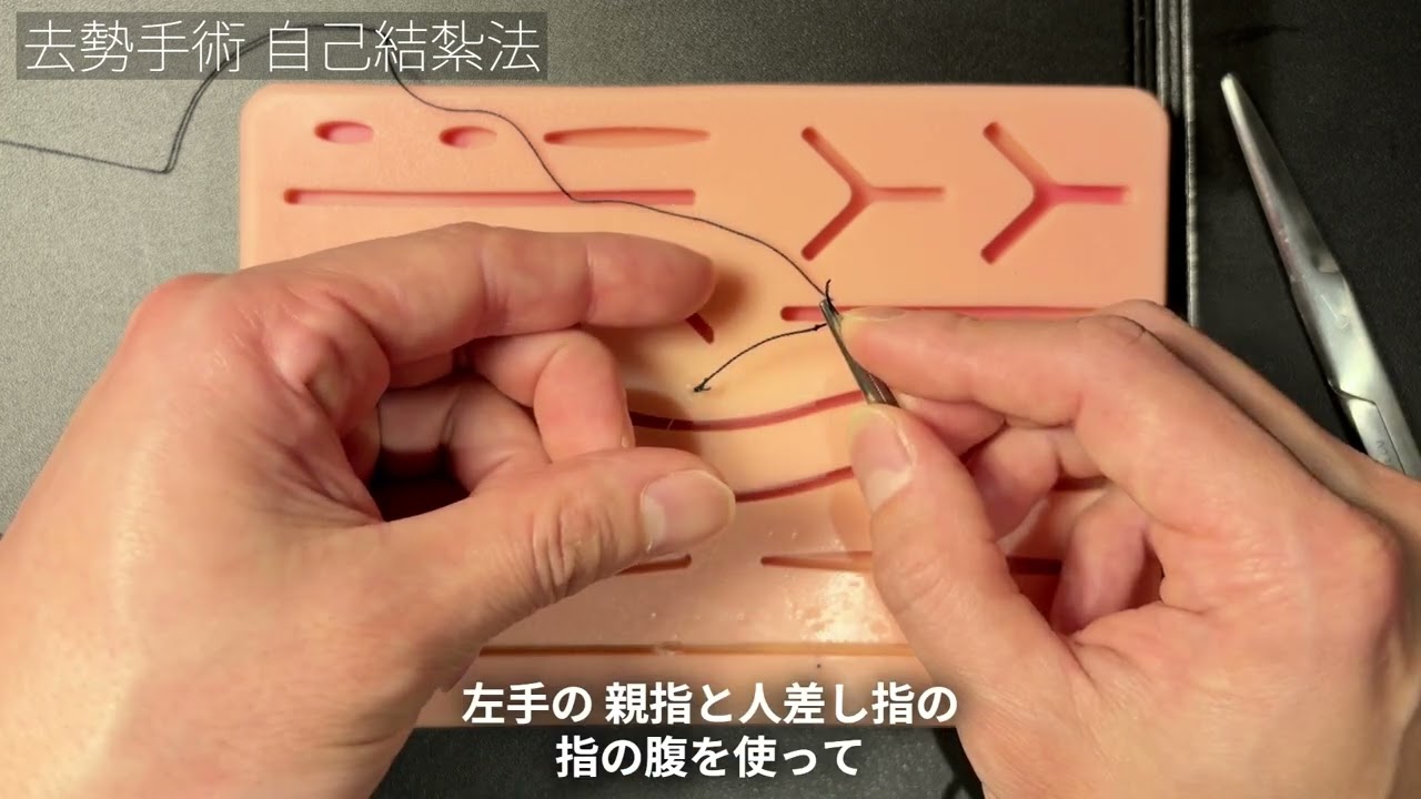 去勢手術 自己結紮法