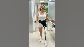Hip dislocation prosthesis gives her a new lease of life #amputee woman #shd #prosthetic