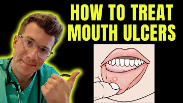 How to recognise and treat Mouth Ulcers (getting rid of canker sores) | Doctor O'Donovan explains...