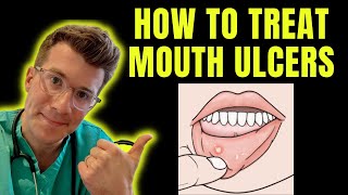 How to recognise and treat Mouth Ulcers (getting rid of canker sores) | Doctor O'Donovan explains...