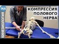 Компрессия полового нерва. Проф. Л.Ф.Васильева. Кинезиология. Германия