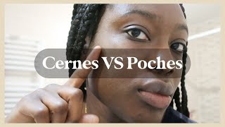 SOIN CONTOUR DES YEUX : focus poches, cernes, pigmentation...