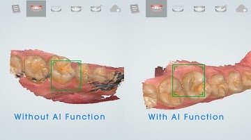 Aoralscan - AI Function
