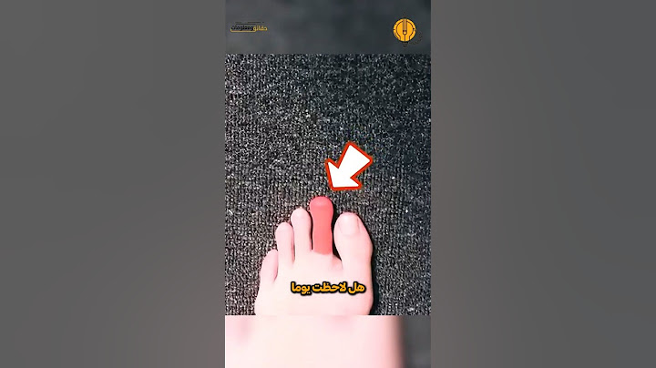 لماذا يبدو إصبع قدمك الثاني أطول من الإبهام؟ السرّ أغرب مما تتخيّل!