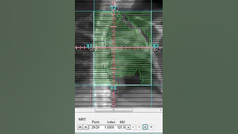 MLCs motion during IMRT sliding window delivery