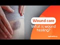 The Science of Wound Healing - Part 2: What is Wound Healing?