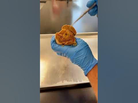 This is REAL Human Bone Marrow - YouTube