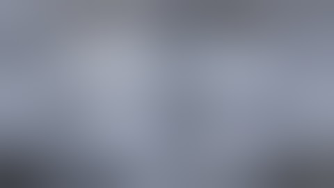 EZgoma®-a Guided Full Mouth Reconstruction using Quad Zygomatic Implants and Pterygoid Implants