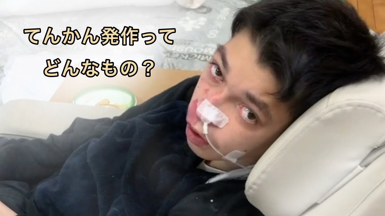 てんかん発作ってどんなもの？