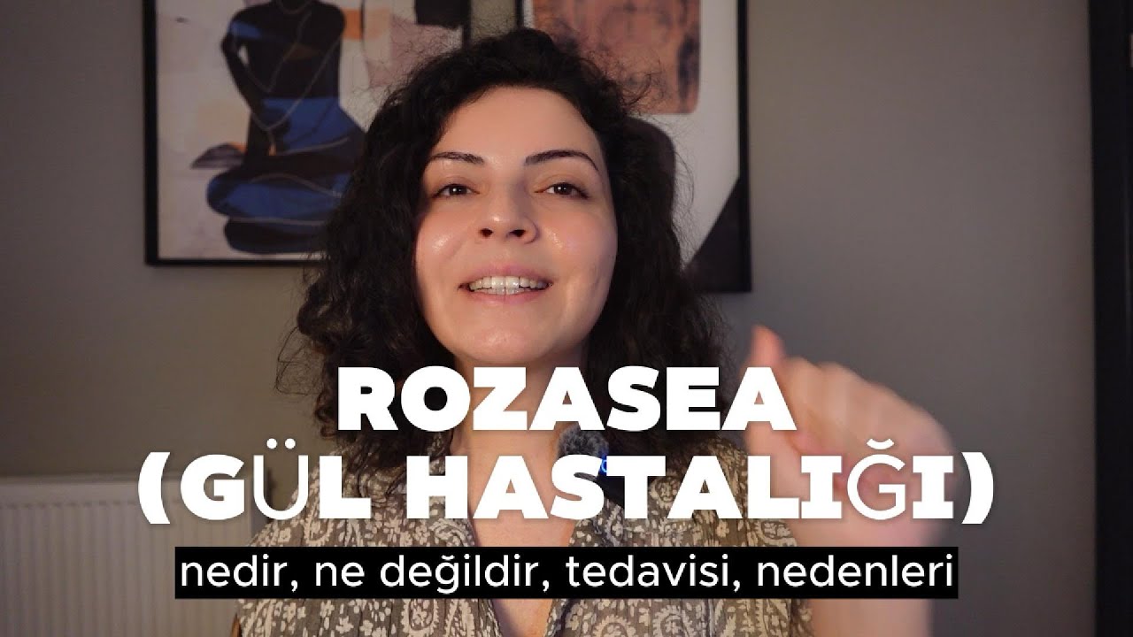 Rozase(Gül hastalığı) nedir? Nasıl tedavi edilir?