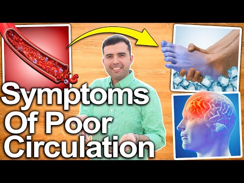 POOR CIRCULATION! - Symptoms, Causes and Solutions to Improve Bad Circulation