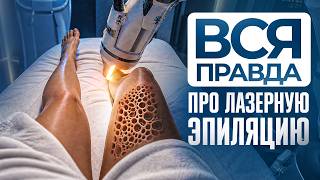 Лазерная эпиляция: ЧТО СКРЫВАЮТ косметологи?