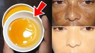 कालापन दाग-धब्बे मिटाकर चेहरा बेहद साफ-गोरा बना देगा | skin whitening | get clear and fair skin tips