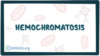 Watch the full video, for free, here: osms.it/hemochromatosis-video
what is hemochromatosis? hemochromatosis a genetic disorder where body
isn’t able ...