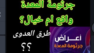 9-ازاى تعرف انك مصاب بجرثومة المعدة  ??أعراضها طريقة العدوى?هل كل الناس مصابين بيها بدون اعراض