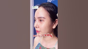 Chi 300 triệu NÂNG MŨI CAO TÂY thành mũi PHÙ THỦY nhọn hoắc nạn nhân cầu cứu Bác sĩ Tú Dung