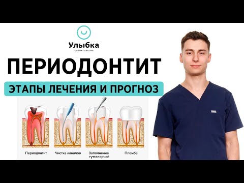 Периодонтит Зуба. Лечение периодонтита у детей и взрослых - Одесса, стоматология Улыбка