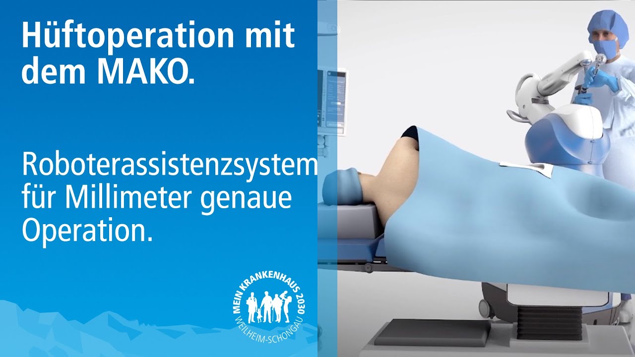 Huft Tep Op Komplikationen Bei Einer Huftprothese Messbar Reduzieren Mako Roboter Assistenz Youtube
