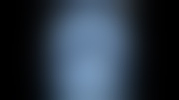 TRIGEMINAL NEURALGIA-MICRO VASCUALR DECOMPRESSION (MVD )--dr suresh dugani/HUBBALLI/KARNATAKA/INDIA